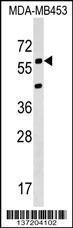 Anti-KCNS3 Rabbit Polyclonal Antibody (FITC (Fluorescein Isothiocyanate))