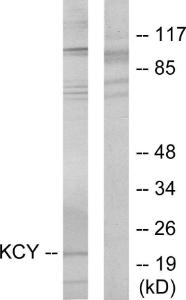 Western blot analysis of lysates from HeLa cells using Anti-KCY Antibody. The right hand lane represents a negative control, where the antibody is blocked by the immunising peptide.