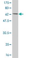 Anti-CKB Mouse Monoclonal Antibody [clone: 3D5-3D11]