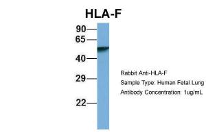 Anti-HLA-F Rabbit Polyclonal Antibody