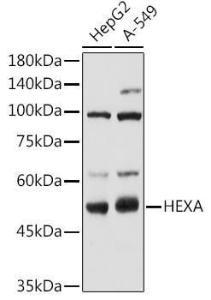 Western blot analysis of extracts of various cell lines, using Anti-HEXA Antibody (A306320) at 1:1,000 dilution. The secondary antibody was Goat Anti-Rabbit IgG H&L Antibody (HRP) at 1:10,000 dilution.