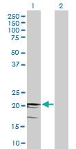 Anti-CD3D Mouse Polyclonal Antibody