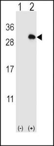 Anti-14-3-3 gamma Rabbit Polyclonal Antibody (FITC (Fluorescein Isothiocyanate))