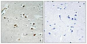 Antibody anti-P55CDC 100 µg