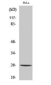 Western blot analysis of various cells using Anti-KCY Antibody