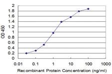 Anti-SLC11A2 Mouse Monoclonal Antibody [clone: 4G2]