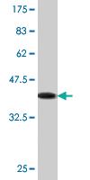 Anti-IFT57 Mouse Monoclonal Antibody [clone: 1G8]