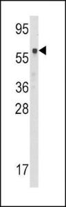 Anti-CBS Rabbit Polyclonal Antibody (PE (Phycoerythrin))