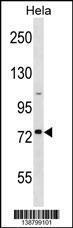 Anti-GOLGA8H Rabbit Polyclonal Antibody (AP (Alkaline Phosphatase))