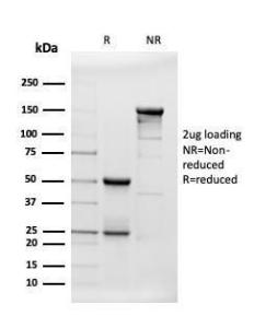 SDS-PAGE analysis of Anti-beta Amyloid Antibody [APP/3343] under non-reduced and reduced conditions; showing intact IgG and intact heavy and light chains, respectively. SDS-PAGE analysis confirms the integrity and purity of the antibody