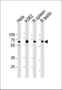 Anti-HDAC1 Rabbit Polyclonal Antibody (HRP (Horseradish Peroxidase))