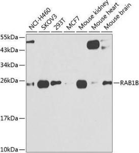 Western blot analysis of extracts of various cell lines, using Anti-RAB1B Antibody (A309223) at 1:1,000 dilution. The secondary antibody was Goat Anti-Rabbit IgG H&L Antibody (HRP) at 1:10,000 dilution.