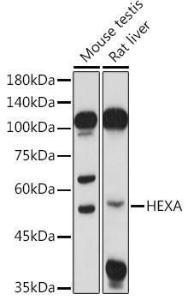 Western blot analysis of extracts of various cell lines, using Anti-HEXA Antibody (A306320) at 1:1,000 dilution. The secondary antibody was Goat Anti-Rabbit IgG H&L Antibody (HRP) at 1:10,000 dilution.