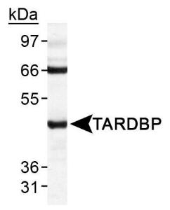 Anti-TARDBP Rabbit Polyclonal Antibody