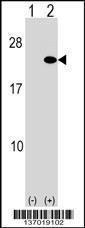 Anti-ARF5 Rabbit Polyclonal Antibody (PE (Phycoerythrin))