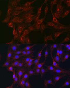 Immunofluorescence analysis of C6 cells using Anti-RAB1B Antibody (A309223) at a dilution of 1:100 (40x lens). DAPI was used to stain the cell nuclei (blue).