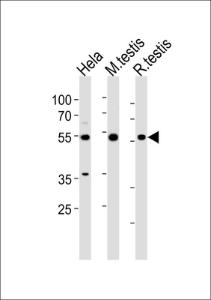 Anti-HDAC1 Rabbit Polyclonal Antibody (AP (Alkaline Phosphatase))