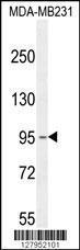 Anti-KCNT2 Rabbit Polyclonal Antibody (FITC (Fluorescein Isothiocyanate))