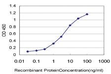 Anti-GNRHR2 Mouse Monoclonal Antibody [clone: 4A5]