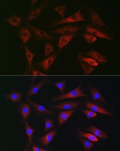 Immunofluorescence analysis of NIH-3T3 cells using Anti-RAB1B Antibody (A309223) at a dilution of 1:100 (40x lens). DAPI was used to stain the cell nuclei (blue).