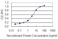 Anti-GOT1 Mouse Monoclonal Antibody [clone: 4G4]