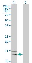 Anti-NLGN4Y Rabbit Polyclonal Antibody