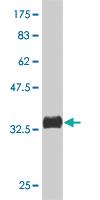 Anti-PAK4 Mouse Monoclonal Antibody [clone: 3F10]