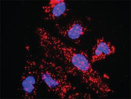 Anti-TBL1X + CTNNB1 Antibody Pair