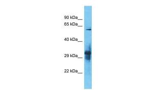 Anti-IGLON5 Rabbit Polyclonal Antibody