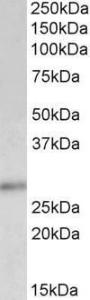 Anti-CDKN1B Antibody (A83767) (0.5 µg/ml) staining of Human Breast lysate (35 µg protein in RIPA buffer). Primary incubation was 1 hour. Detected by chemilu minescence