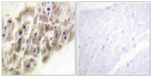 Immunohistochemical analysis of paraffin-embedded human heart using Anti-MAPKAPK-2 (phospho Thr222) Antibody. The right hand panel represents a negative control, where the Antibody was pre-incubated with the immunising peptide