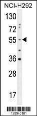 Anti-OTUD1 Rabbit Polyclonal Antibody (PE (Phycoerythrin))