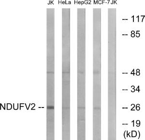 Western blot analysis of lysates from Jurkat, HeLa, HepG and MCF-7 cells using Anti-NDUFV2 Antibody. The right hand lane represents a negative control, where the antibody is blocked by the immunising peptide