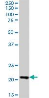 Anti-LZIC Mouse Polyclonal Antibody