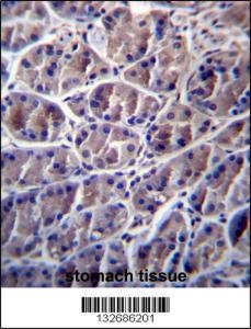 Anti-CAPN8 Rabbit Polyclonal Antibody