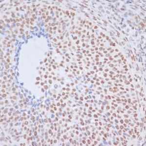 Immunohistochemistry analysis of paraffin-embedded rat ovary using Anti-Histone H1.4 (acetyl Lys26) Antibody (A305416) at a dilution of 1:200 (40X lens). Perform microwave antigen retrieval with 10 mM PBS buffer pH 7.2 before commencing with IHC staining protocol