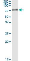 Anti-PLAT Polyclonal Antibody Pair