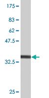 Anti-MKNK1 Mouse Monoclonal Antibody [clone: 2E5]