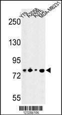 Anti-CSRP2BP Rabbit Polyclonal Antibody (FITC (Fluorescein))