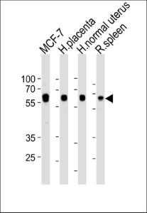 Anti-HDAC1 Rabbit Polyclonal Antibody (AP (Alkaline Phosphatase))