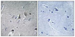 Immunohistochemical analysis of paraffin-embedded human brain using Anti-NDUFV2 Antibody 1:100 (4°C overnight). The right hand panel represents a negative control, where the antibody was pre-incubated with the immunising peptide