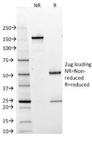 SDS-PAGE analysis of Anti-BOB1 Antibody [BOB1/2425] under non-reduced and reduced conditions; showing intact IgG and intact heavy and light chains, respectively. SDS-PAGE analysis confirms the integrity and purity of the antibody