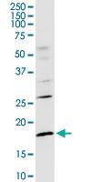 Anti-CD247 Rabbit Polyclonal Antibody