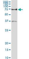 Anti-VTN Polyclonal Antibody Pair