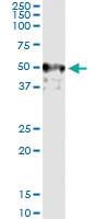 Anti-XIAP Polyclonal Antibody Pair