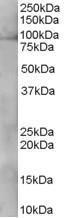 Anti-XAB2 antibody