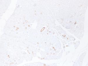 Immunohistochemical analysis of paraffin-embedded human Pancreas using Anti-Cytokeratin 19 Antibody