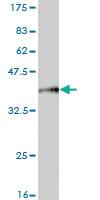 Anti-MARCH6 Mouse Monoclonal Antibody [clone: 2F7]