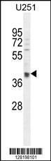 Anti-OTUD3 Rabbit Polyclonal Antibody (AP (Alkaline Phosphatase))