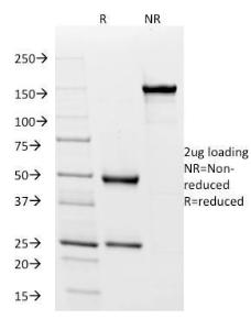 SDS-PAGE analysis of Anti-Human IgD Heavy Chain Antibody [IgD26] under non-reduced and reduced conditions; showing intact IgG and intact heavy and light chains, respectively. SDS-PAGE analysis confirms the integrity and purity of the antibody